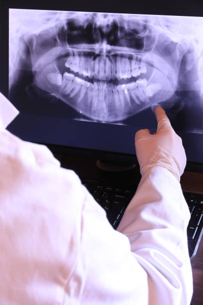 Best Emergency Treatment for Dental Infections or Abscesses in Assumption, IL